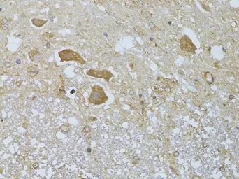 Anti-HDAC8 antibody used in IHC (Paraffin sections) (IHC-P). GTX57746