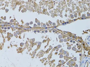 Anti-HDAC8 antibody used in IHC (Paraffin sections) (IHC-P). GTX57746