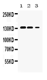 Anti-JAK1 antibody used in Western Blot (WB). GTX57747