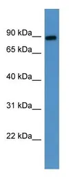 Anti-LOXL3 antibody used in Western Blot (WB). GTX57750