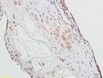 Anti-PPAR gamma antibody used in IHC (Paraffin sections) (IHC-P). GTX57756