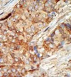 Anti-Glucokinase antibody, N-term used in IHC (Paraffin sections) (IHC-P). GTX59598