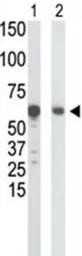Anti-Glucokinase antibody, N-term used in Western Blot (WB). GTX59598