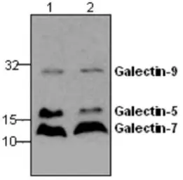 Anti-Galectin 9 antibody used in Western Blot (WB). GTX59744