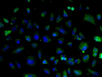 Anti-Cyclin D2 antibody used in Immunocytochemistry/ Immunofluorescence (ICC/IF). GTX60131