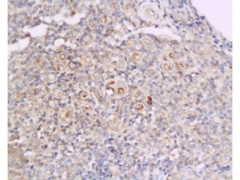 Anti-Cyclin D2 antibody used in IHC (Paraffin sections) (IHC-P). GTX60131