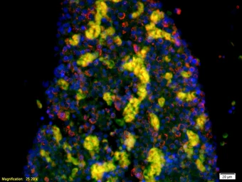 Anti-Serotonin Transporter antibody used in IHC (Paraffin sections) (IHC-P). GTX60132