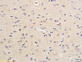 Anti-SDHD antibody used in IHC (Paraffin sections) (IHC-P). GTX60136