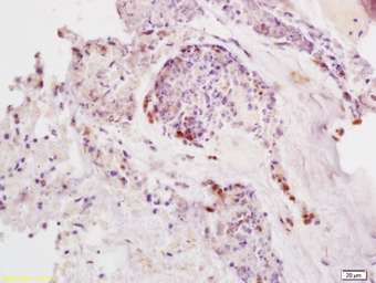 Anti-SDHD antibody used in IHC (Paraffin sections) (IHC-P). GTX60136