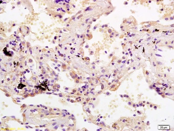 Anti-SDHC antibody used in IHC (Paraffin sections) (IHC-P). GTX60139
