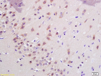 Anti-SHANK3 antibody used in IHC (Paraffin sections) (IHC-P). GTX60153