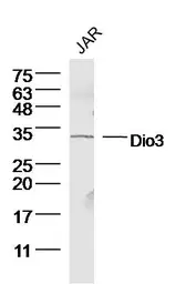 Anti-DIO3 antibody used in Western Blot (WB). GTX60156