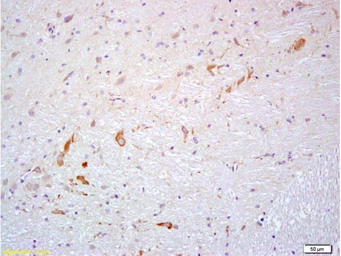 Anti-Prokineticin 2 antibody used in IHC (Paraffin sections) (IHC-P). GTX60189
