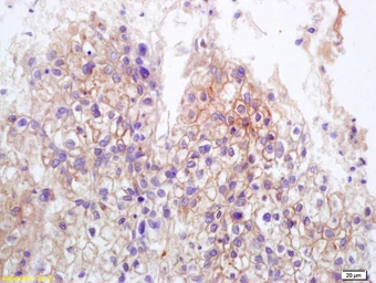 Anti-MICB antibody used in IHC (Paraffin sections) (IHC-P). GTX60191