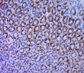 Anti-BTG1 antibody used in IHC (Paraffin sections) (IHC-P). GTX60192