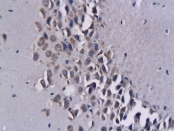 Anti-CXCL16 antibody used in IHC (Paraffin sections) (IHC-P). GTX60199