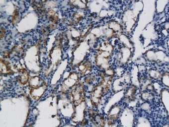 Anti-CXCL11 antibody used in IHC (Paraffin sections) (IHC-P). GTX60204