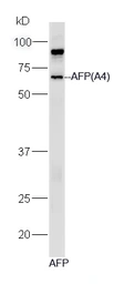 Anti-Alpha fetoprotein / AFP antibody [A4] used in Western Blot (WB). GTX60215
