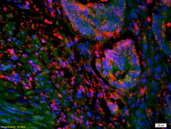 Anti-SOAT2 antibody used in IHC (Paraffin sections) (IHC-P). GTX60244