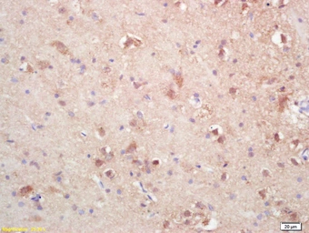 Anti-SOAT2 antibody used in IHC (Paraffin sections) (IHC-P). GTX60244