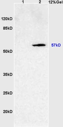 Anti-SOAT2 antibody used in Western Blot (WB). GTX60244