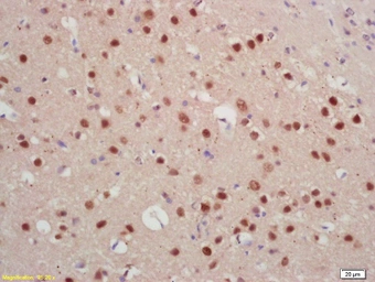 Anti-JARID2 antibody used in IHC (Paraffin sections) (IHC-P). GTX60262