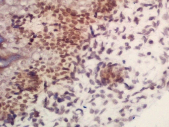 Anti-ARID1B antibody used in IHC (Paraffin sections) (IHC-P). GTX60275