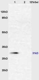 Anti-Fetuin A antibody used in Western Blot (WB). GTX60278