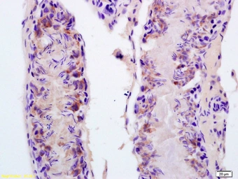 Anti-FASTKD5 antibody used in IHC (Paraffin sections) (IHC-P). GTX60304