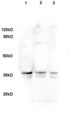 Anti-DLK1 antibody used in Western Blot (WB). GTX60309