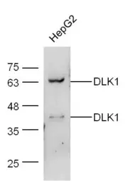 Anti-DLK1 antibody used in Western Blot (WB). GTX60309