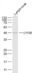 Anti-SLAMF6 antibody used in Western Blot (WB). GTX60322