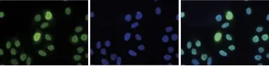 Anti-Histone H3K9me3S10ph (Tri-methyl Lys9/phospho Ser10) antibody - ChIP grade used in Immunocytochemistry/ Immunofluorescence (ICC/IF). GTX60327