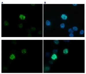 Anti-Histone H3K27me3S28ph (Tri-methyl Lys27/phospho Ser28) antibody - ChIP grade used in Immunocytochemistry/ Immunofluorescence (ICC/IF). GTX60329