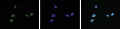 Anti-Histone H4K5K8K12K16ac (acetyl Lys5/Lys8/Lys12/Lys16) antibody - ChIP grade used in Immunocytochemistry/ Immunofluorescence (ICC/IF). GTX60334