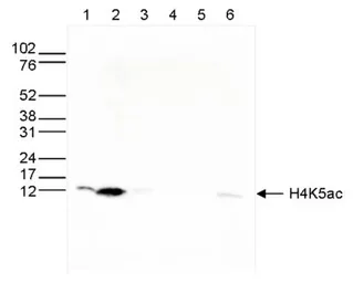 Anti-Histone H4K5ac (acetyl Lys5) antibody - ChIP grade used in Western Blot (WB). GTX60335