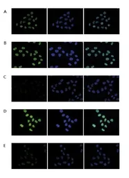 Anti-Histone H4K5K8K12ac (acetyl Lys5/Lys8/Lys12) antibody - ChIP grade used in Immunocytochemistry/ Immunofluorescence (ICC/IF). GTX60337