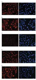 Anti-Histone H3K27me1 (Mono-methyl Lys27) antibody - ChIP grade used in Immunocytochemistry/ Immunofluorescence (ICC/IF). GTX60350