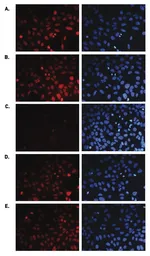 Anti-Histone H3K36me1 (Mono-methyl Lys36) antibody - ChIP grade used in Immunocytochemistry/ Immunofluorescence (ICC/IF). GTX60354