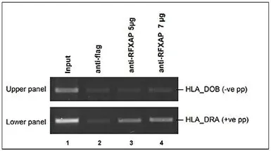 Anti-RFXAP antibody - ChIP grade used in ChIP assay (ChIP assay). GTX60368