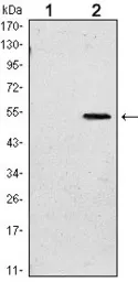 Anti-SUZ12 antibody [3D10] used in Western Blot (WB). GTX60380