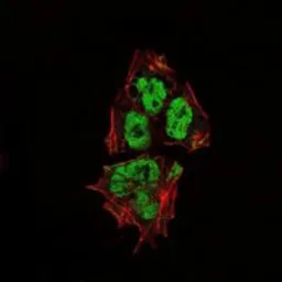 Anti-SOX2 antibody [10F10] used in Immunocytochemistry/ Immunofluorescence (ICC/IF). GTX60381