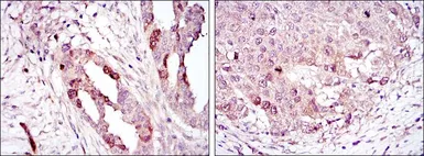 Anti-Aurora A antibody [4G10] used in IHC (Paraffin sections) (IHC-P). GTX60392