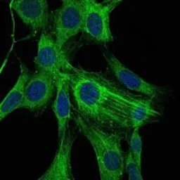Anti-alpha Smooth Muscle Actin antibody [1H8] used in Immunocytochemistry/ Immunofluorescence (ICC/IF). GTX60393