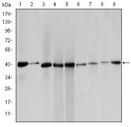 Anti-alpha Smooth Muscle Actin antibody [1H8] used in Western Blot (WB). GTX60393