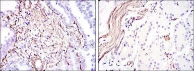 Anti-alpha Smooth Muscle Actin antibody [4F4] used in IHC (Paraffin sections) (IHC-P). GTX60394
