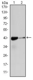 Anti-alpha Smooth Muscle Actin antibody [4F4] used in Western Blot (WB). GTX60394