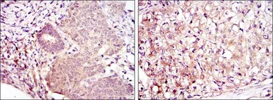 Anti-MEK6 antibody [3H12B9] used in IHC (Paraffin sections) (IHC-P). GTX60397