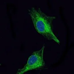 Anti-OLIG2 antibody [1G11] used in Immunocytochemistry/ Immunofluorescence (ICC/IF). GTX60398