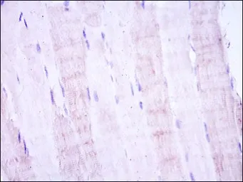 Anti-SEK1 / MKK4 antibody [5H4] used in IHC (Paraffin sections) (IHC-P). GTX60399